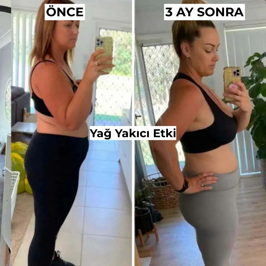 Slimfiks Anti - Selülit Tayt - Slimfiks