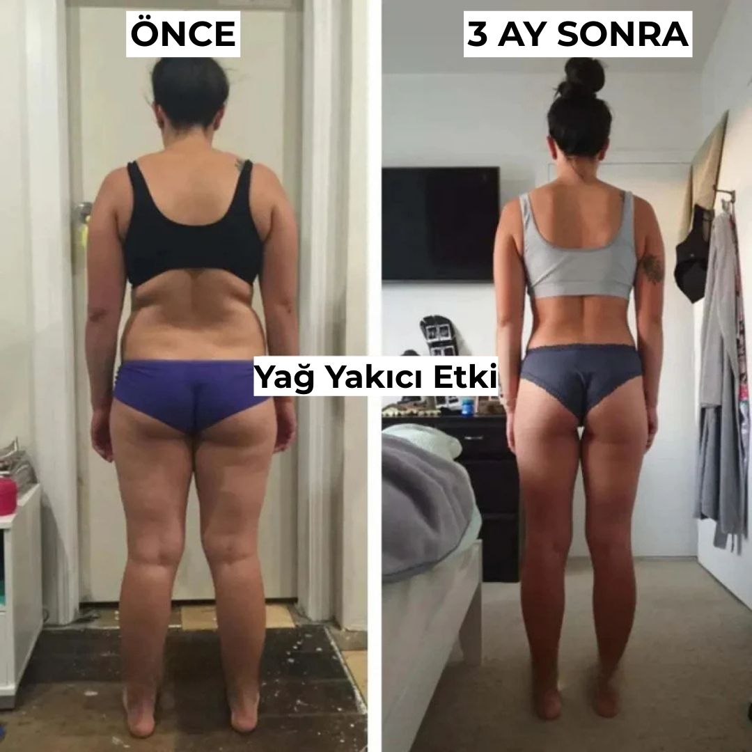 Slimfiks Anti - Selülit Tayt - Slimfiks